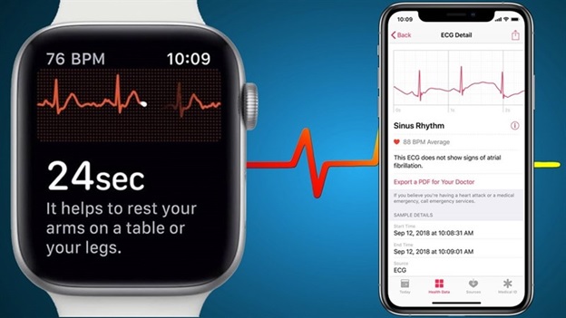 Tính năng ECG của Apple Watch có khả năng phát hiện bệnh thiếu máu cục bộ của người dùng
