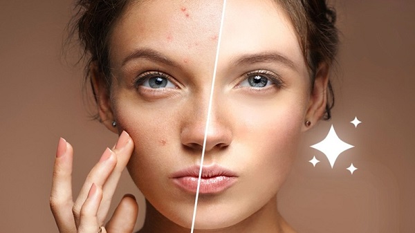 Các app xóa mụn miễn phí, giúp xử lý nhanh các vấn đề trên da
